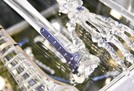 Why Orthopedic Implant Manufacturers Are Important in Modern Healthcare Development